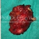Parotid Tumor Surgery in Istanbul - Prof. Cetin Vural, M.D.